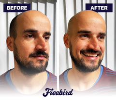 FlexSeries® Shaving Kit